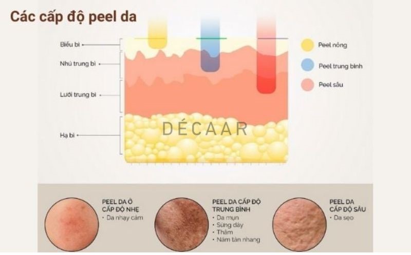chemical peel